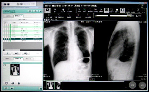 過去の画像を並べて比較したりすることが容易